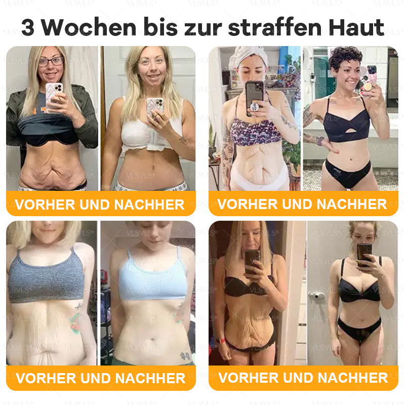 Hergestellt und versendet aus Deutschland 🌸VLSVLS® Bienengift Hautregenerationscreme 🔥 LETZTER TAG 80 % RABATT