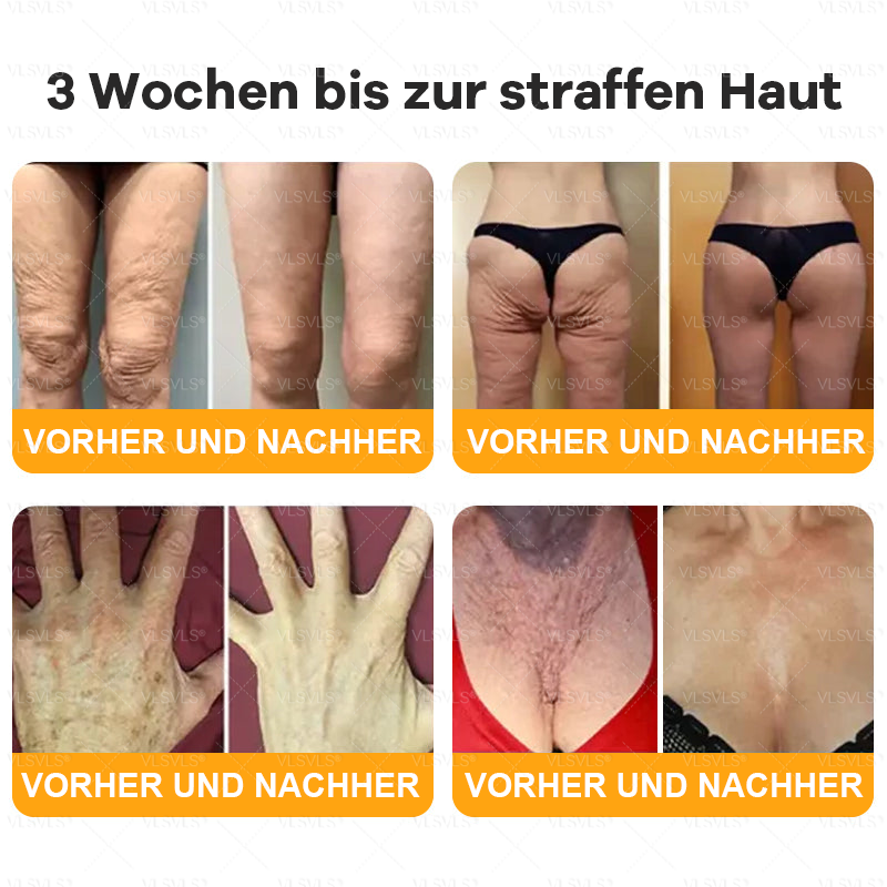 Hergestellt und versendet aus Deutschland 🌸VLSVLS® Bienengift Hautregenerationscreme 🔥 LETZTER TAG 80 % RABATT