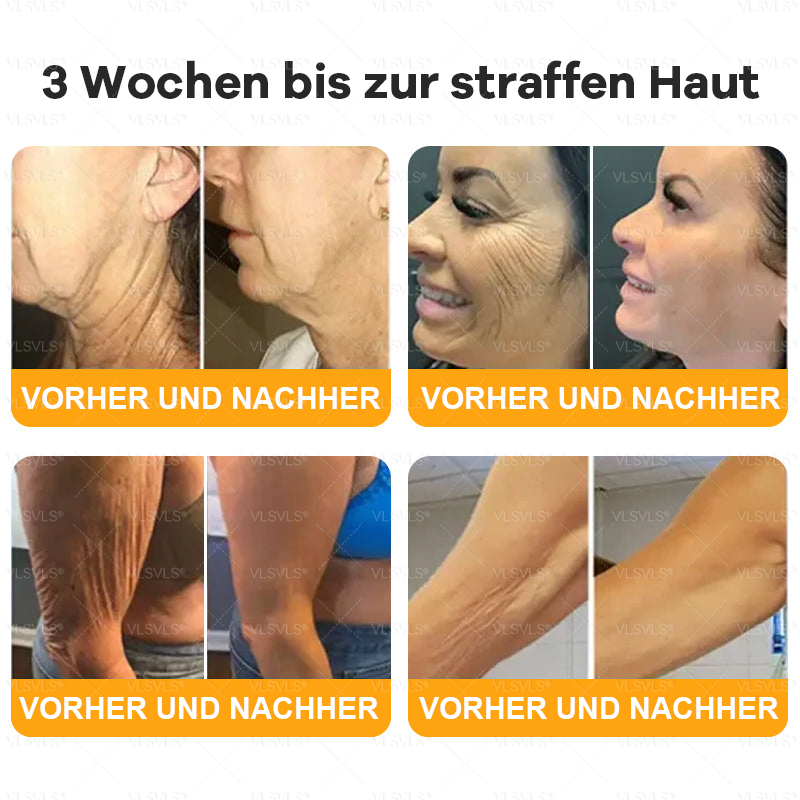 Hergestellt und versendet aus Deutschland 🌸VLSVLS® Bienengift Hautregenerationscreme 🔥 LETZTER TAG 80 % RABATT