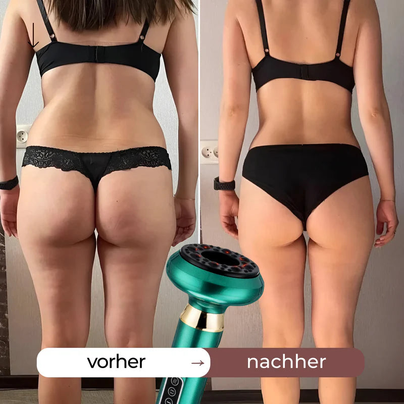 CelluSculpt™ | 4-in-1 Massagegerät – Mit Wärme & Infrarot für Straffere Haut