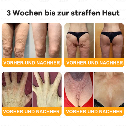 Hergestellt und versendet aus Deutschland  🌸VLSVLS® Bienengift Hautregenerationscreme 🔥 LETZTER TAG 80 % RABATT